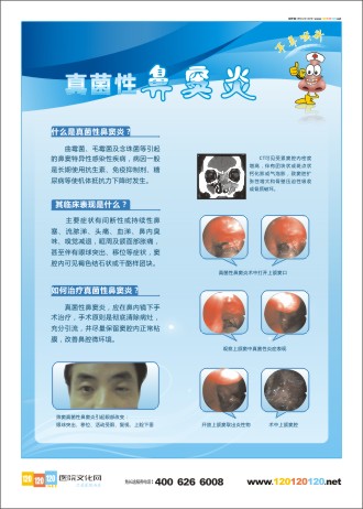 耳鼻喉科宣傳 耳鼻喉科宣傳資料 五官科宣傳欄 耳鼻喉科標(biāo)語 真菌性鼻竇炎