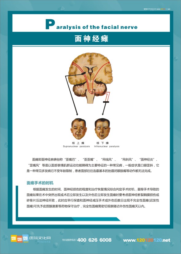 人體神經(jīng)結(jié)構(gòu)圖-面神經(jīng)癱